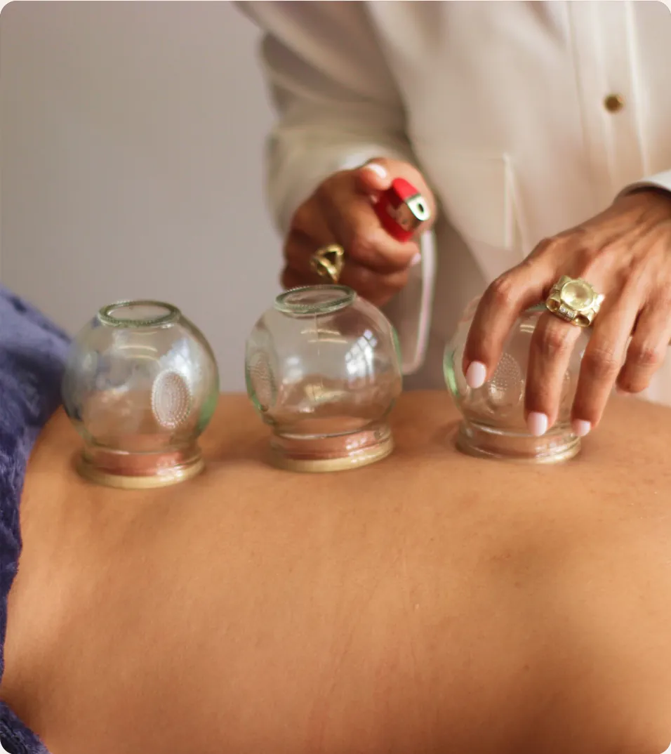 Glass fire cups being placed on a patient’s back
