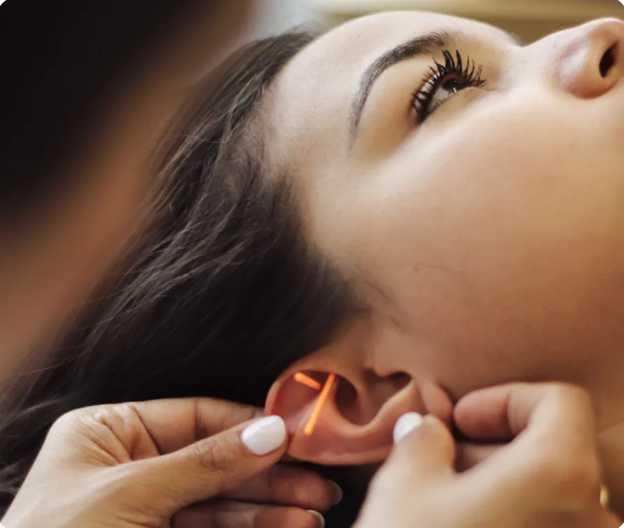 Auricular acupuncture being applied to points on the ear