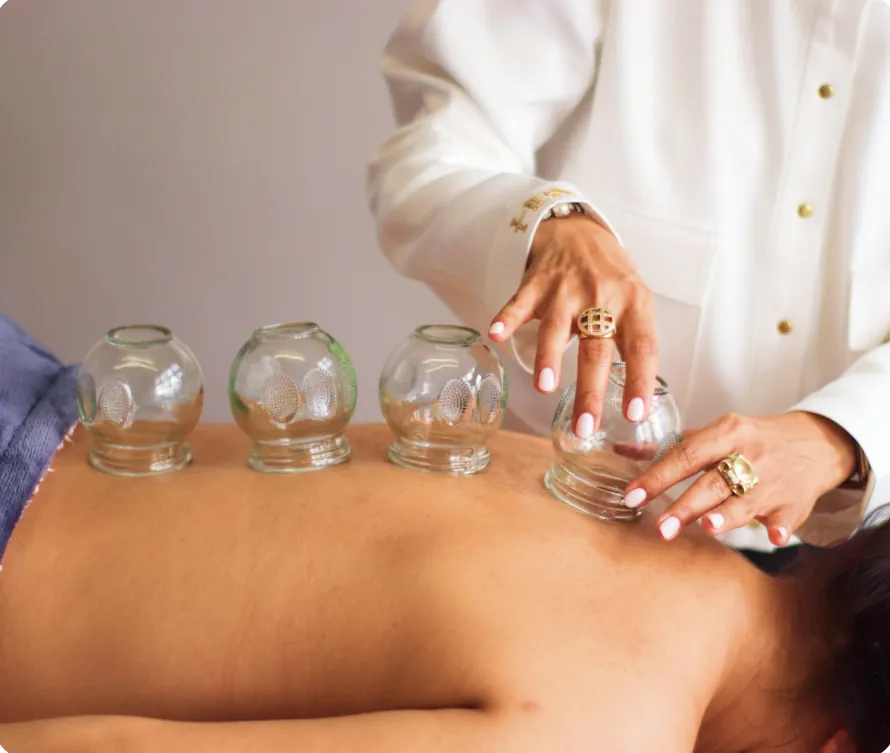 Glass fire cups placed along a patient’s back