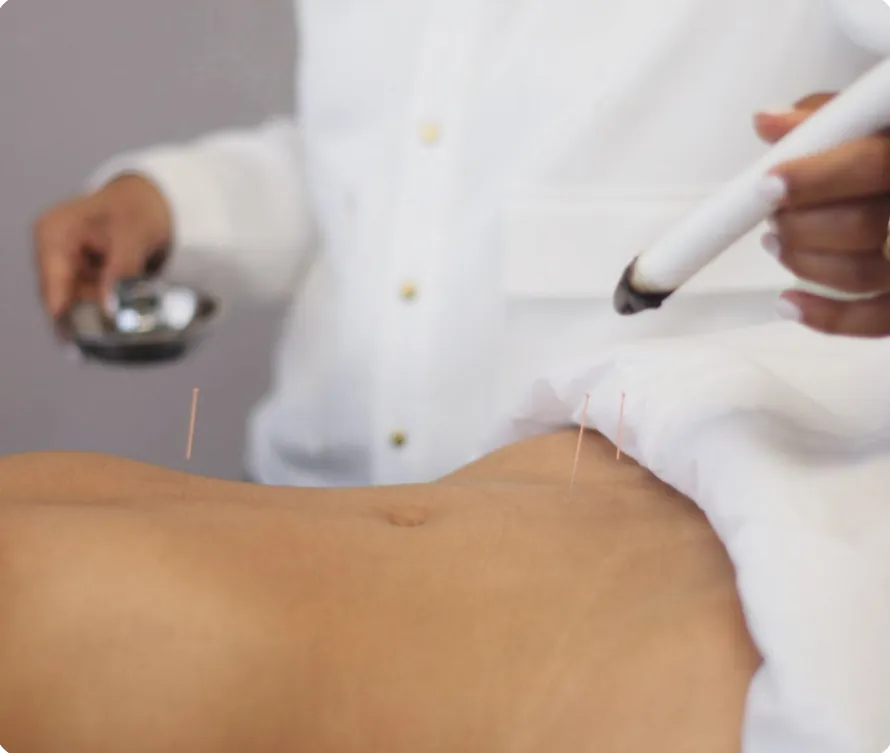 Fertility acupuncture treatment with a heat lamp over the abdomen